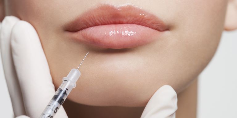 Filler Labbra, come aumentare il volume delle labbra con un intervento mini-invasivo